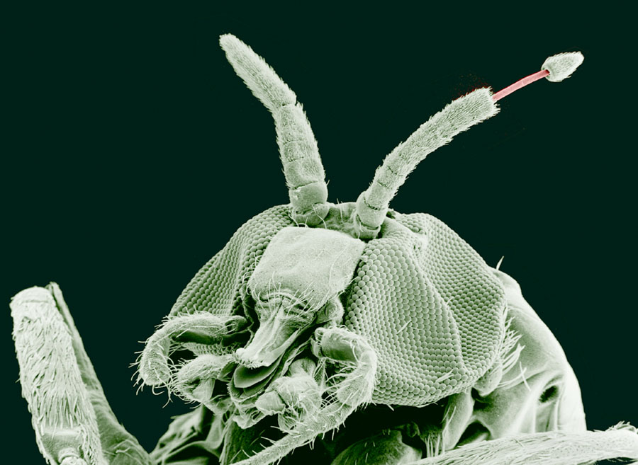 Paraziti hmyzu, Spray antiparazitar și anti- insecte - ml