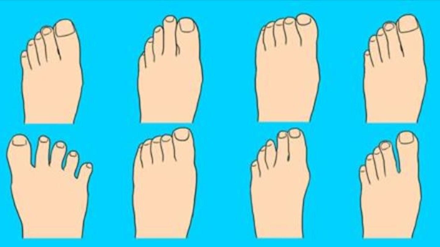 Какие бывают пальцы ног. Форма пальцев на ногах. Форма пальцев стопы. Форма расположения пальцев на ногах. Необычные формы пальцев на ногах.